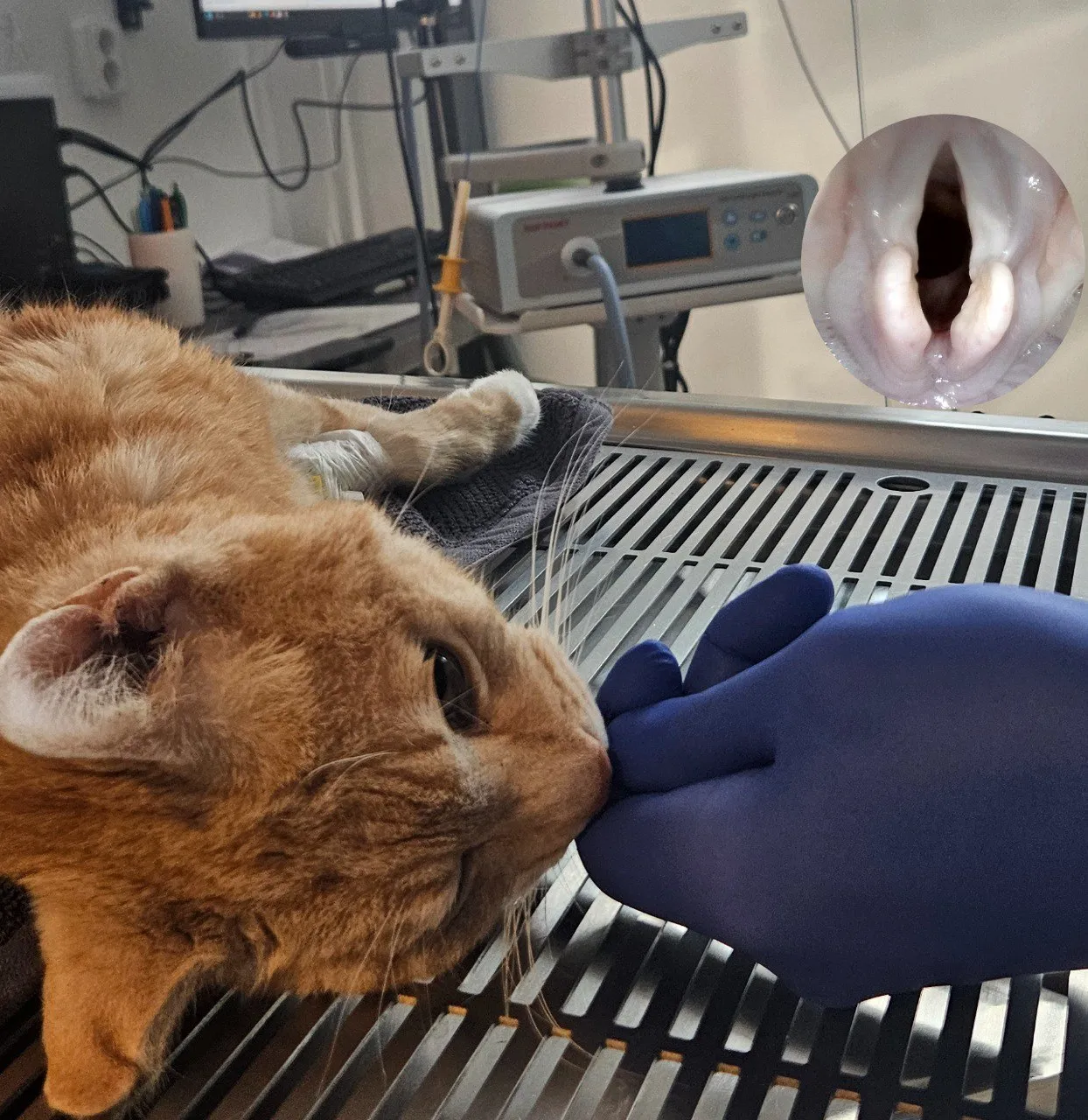 Endoscopy
