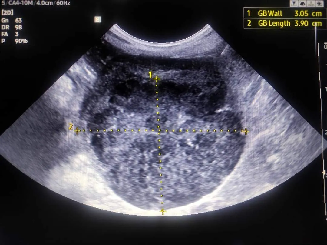 X-ray and ultrasound