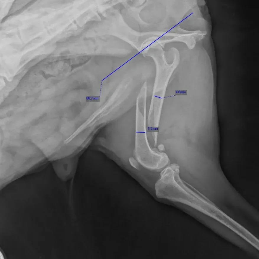 X-ray and ultrasound